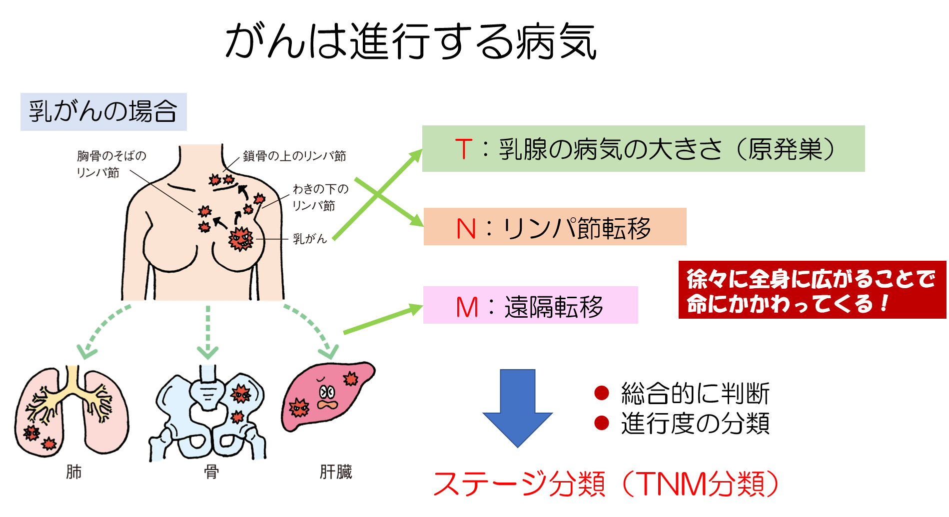 人が変えることができないリスク要因